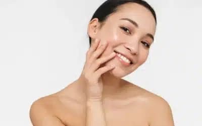IPL for Rosacea, Facial Redness and Broken Capillaries