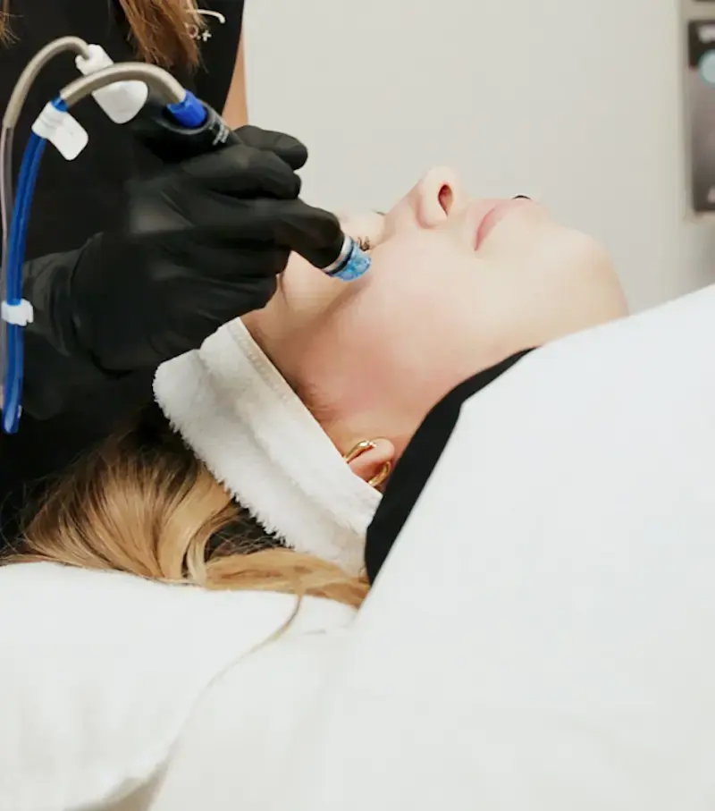 woman receiving hydrafacial treatment at awskinco